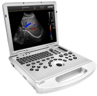 Échographe Doppler DAWEI DW-L3
